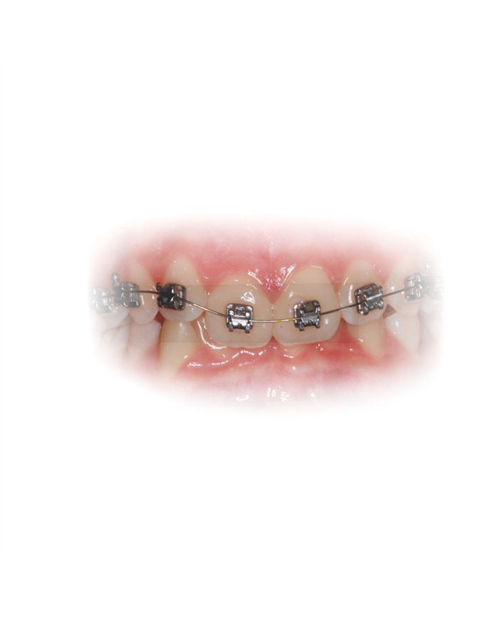 Arcos UltraLeve NiTi Superel -Inf .010"
